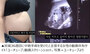 韓国で物議醸す「妊娠36週目で中絶」動画に医師ら激怒「うそでも厳重に処罰を」