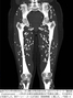 生焼けの豚肉を食べて寄生虫に感染、米研究者が患者のCT写真を公開して注意喚起